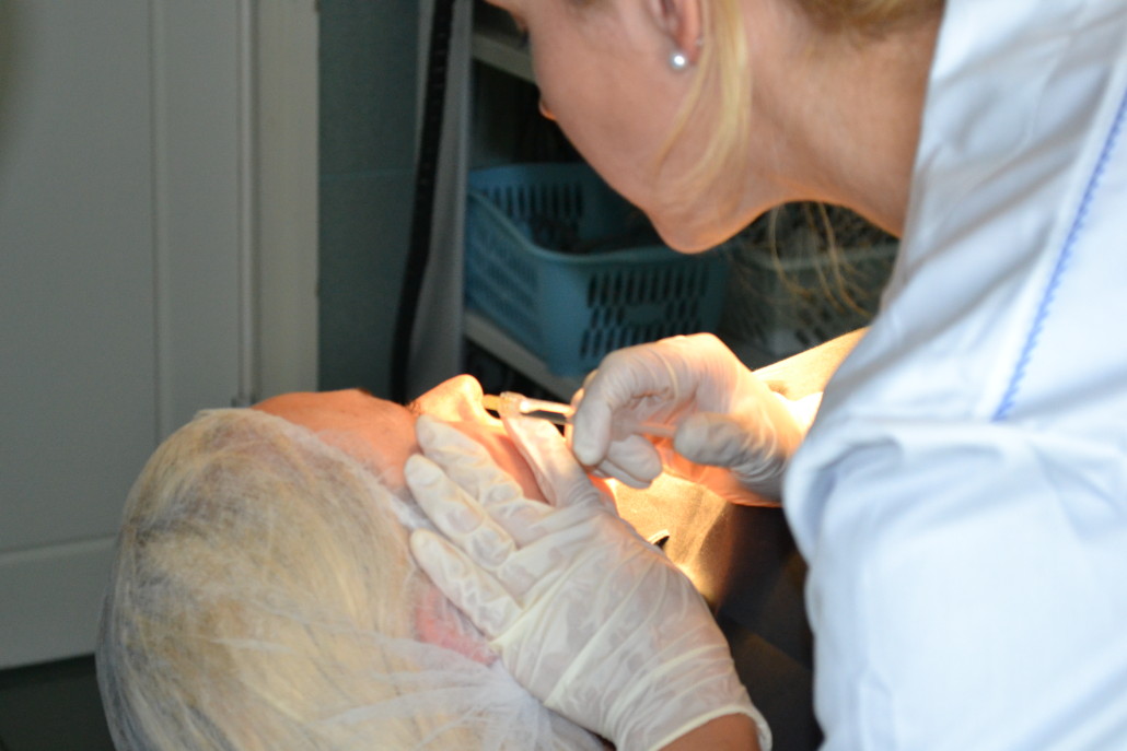 Derma Filler injections