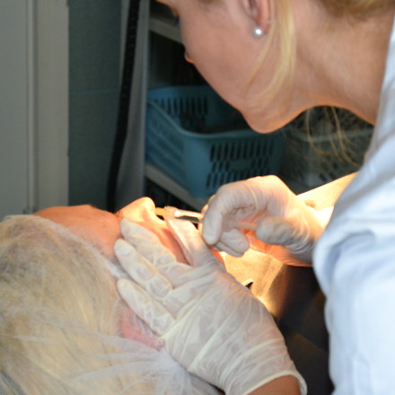 Derma Filler injections